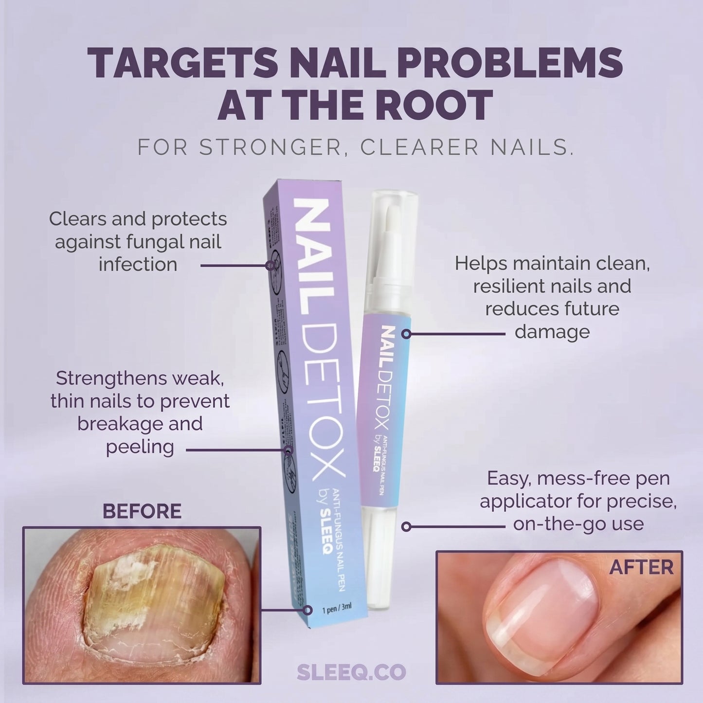 Complete Nail Care  - 3 essential products in 1 kit